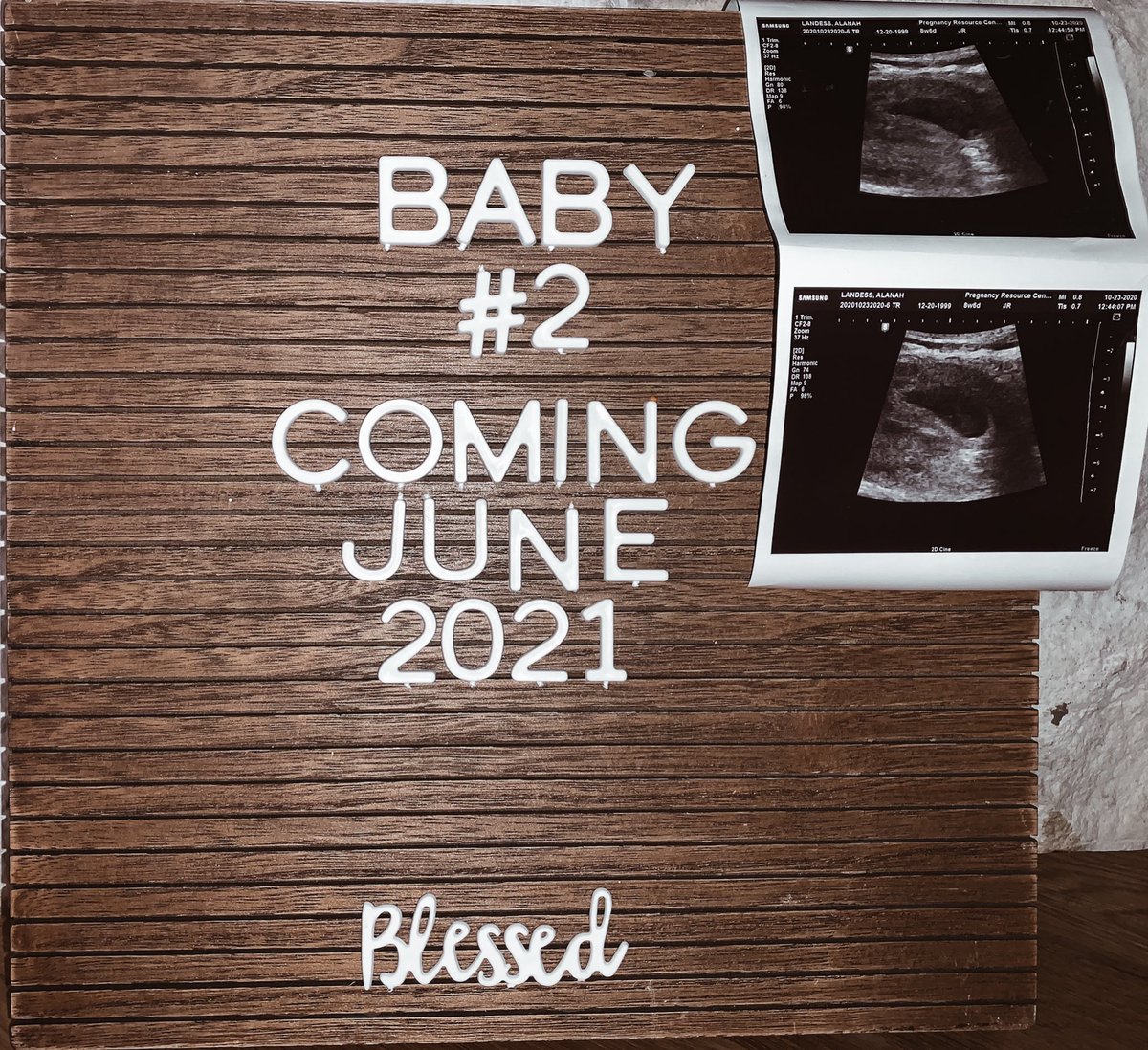 AlanahLandess's tweet photo. blessed 𝚖𝚊𝚖𝚊 
•
•
• 
Jaxons going to be a 𝔹𝕀𝔾 brother 🥺🤍 @56Landess https://t.co/VNPrlBuptK