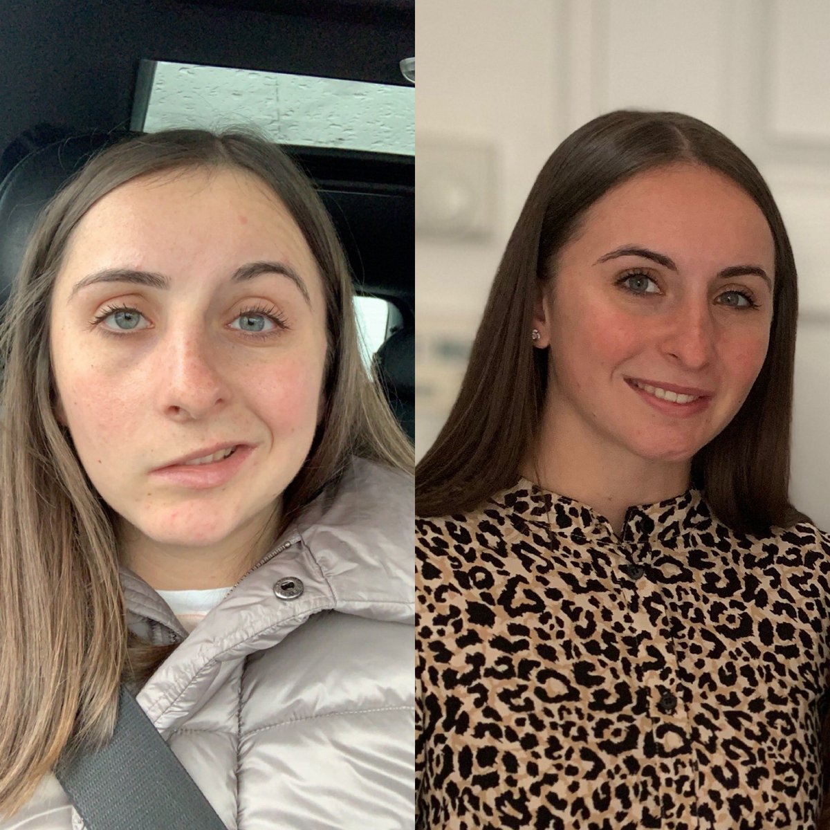 han_binning28's tweet photo. It’s so important to look back on how far you have come... Today I created this picture and I can honestly say I’ve never felt so proud of myself for staying so strong and positive over the last 9 months🤩 #onwardsandupwards #bellspalsy #staystrong @facialpalsyuk https://t.co/yUPw7EFboP