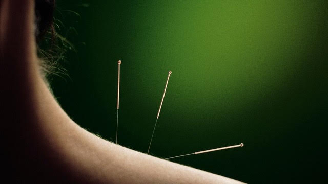 Het bekend dat stress schadelijk is. Maar wat doe je er dan aan? Juist, acupunctuur! In dit artikel leggen we je uit hoe acupunctuur je kan helpen de schadelijke effecten van stress te voorkomen of herstellen.

stressplein.nl/acupunctuur-en… #stressplein #stress #acupunctuur