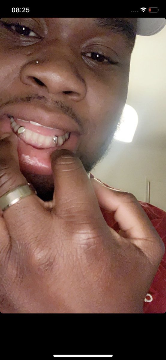 July: Double canines for  @Uncle_De IG: MetalMouthJewellers