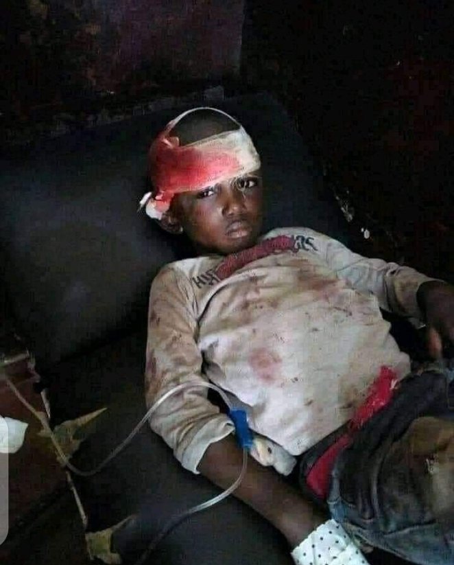 SiirStephen's tweet photo. Survivor of the Kumba massacre ysterday, children suffering a crisis they know nothg about.
Many things running on his mind.
Just give it some time ..sure he will speak out.
#Kumba
#KumbaIsBleeding 
#EndAnglophoneCrisis https://t.co/czprsS4RC2
