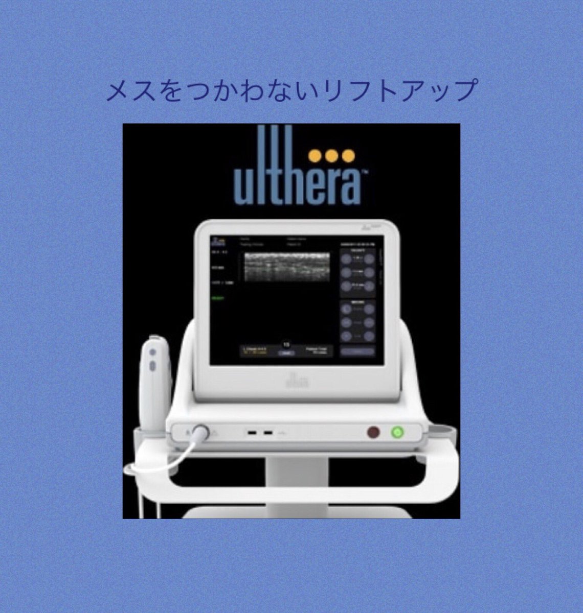 リフトアップ効果