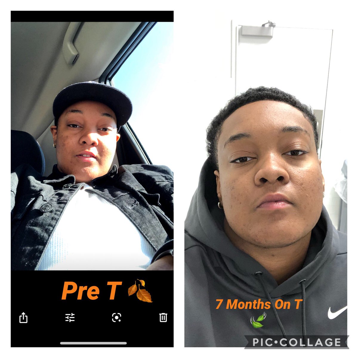 DONBOYJASON's tweet photo. Times Flying By ๐ Made 7 Months On T ๐๐๐ #ftm #transgender #transbeard #topsurgery https://t.co/zCLco4CxMl