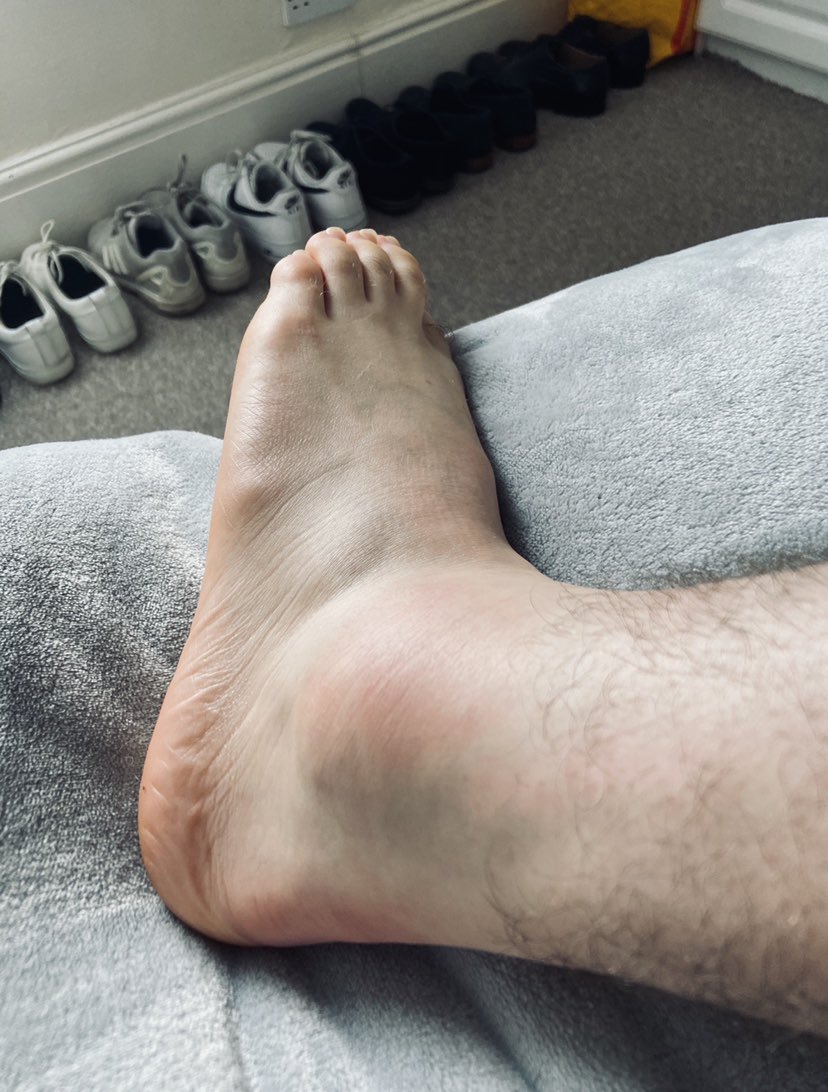 afcExeterGently's tweet photo. Gents centre backs 🤝 Ankle injuries

Please form an orderly queue ladies #UTG https://t.co/hwp7s3jvdi