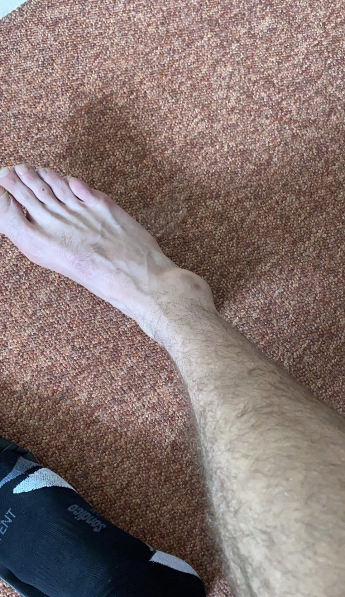 afcExeterGently's tweet photo. Gents centre backs 🤝 Ankle injuries

Please form an orderly queue ladies #UTG https://t.co/hwp7s3jvdi