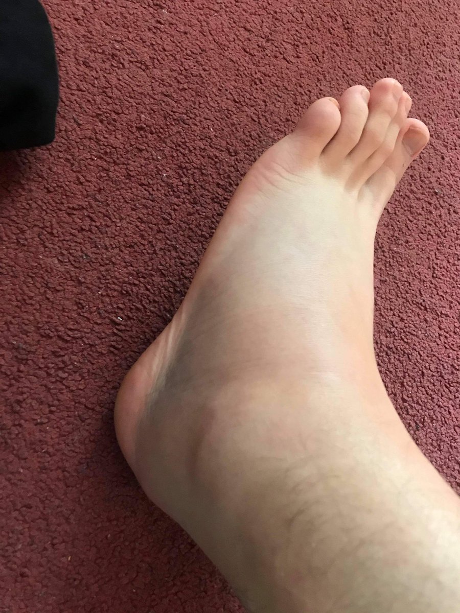 afcExeterGently's tweet photo. Gents centre backs 🤝 Ankle injuries

Please form an orderly queue ladies #UTG https://t.co/hwp7s3jvdi