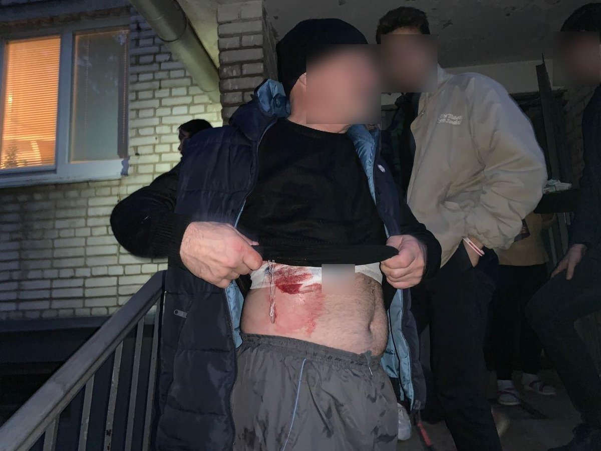 HannaLiubakova's tweet photo. #Belarus Doctors report that 10 ambulances left the spot in #Minsk after the explosions. We don't know the exact number of those who were wounded and injured, but you can see that operating rooms in a military hospital are working. 100+ people were detained - the number will grow https://t.co/h7jBTXYl5g