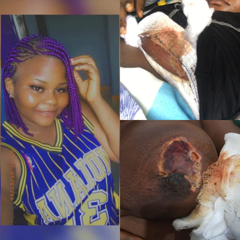 Chukwinks's tweet image. Peace a young Nigerian student of AAU Is battling with Cancer of the breast. Any amount would be appreciated 🙏🏽

3121661985
Nwaokenye  peace
first bank.

help to save her life. God bless you all.

#savepeace
#breastcancer 
#basedonwhat 
#money