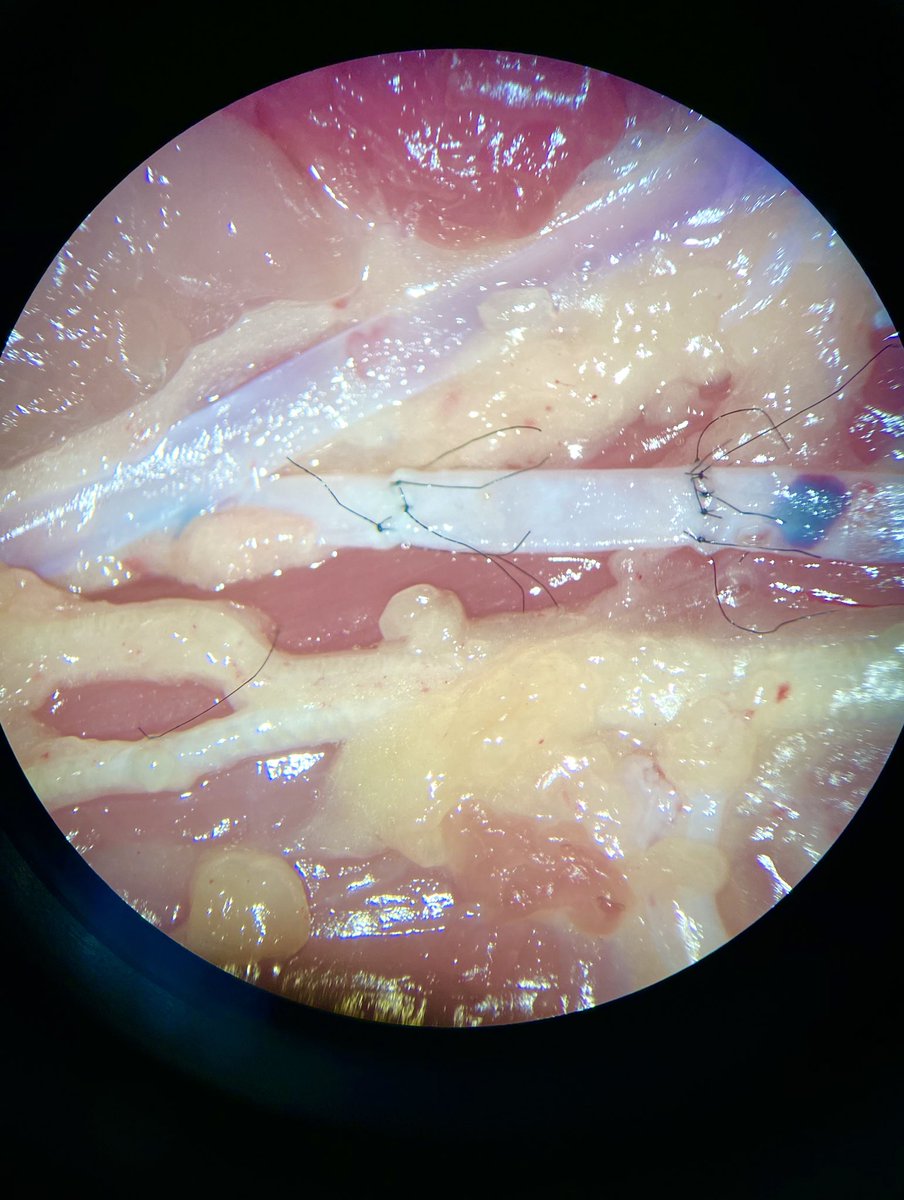 Got to practice microsurgery for the first time! Huge thanks to the residents who took me through it step by step and the H-E-B chicken who donated its body to science 🐔👼🏼