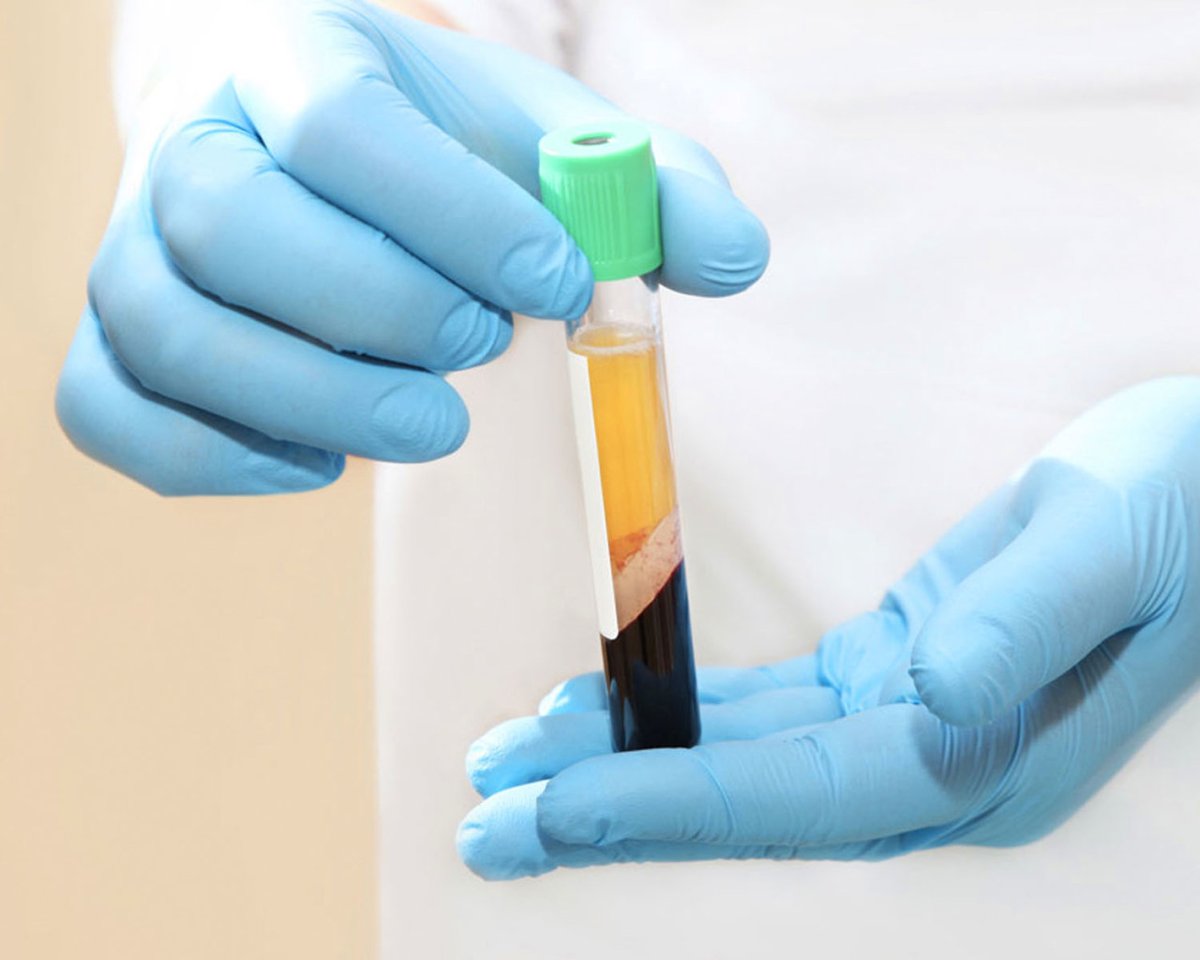 OaaFoundation's tweet photo. Platelet Rich Plasma, PRP,  is a new revolutionary procedure that is being used to help rapidly heal patients using their own platelets. We are using this procedure at OAA to help heal our patients from long time pains.
Contact us today to learn more https://t.co/I3e9brhFuj 💉🩸 https://t.co/kVVisGvzhu
