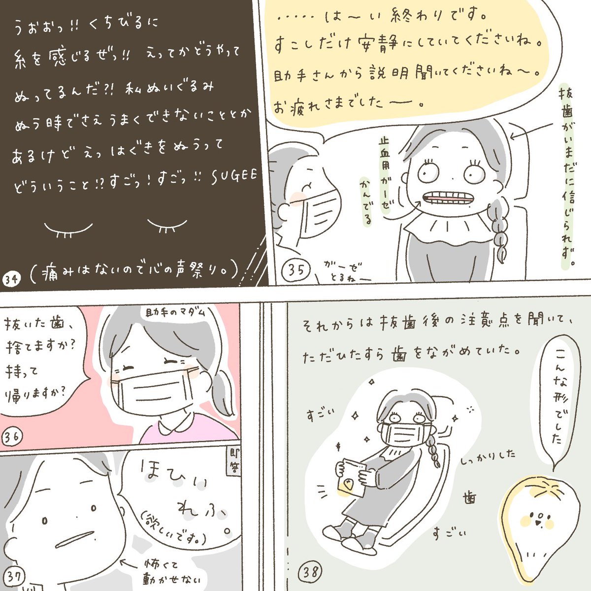 親知らず抜歯しました。(右上の歯) 