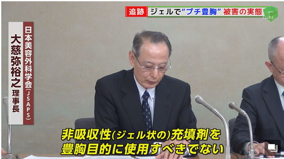 CapillusJapan's tweet photo. 育毛医療で見られる問題が、プチ豊胸でも起きていると報道されています。
https://t.co/9j5Jz7Pn3n
リスクを覚悟して、育毛医療を望んでいない方はぜひ読んでください。専門家から認められた、安全・効果的な低出力レーザー育毛という方法もあります。 #capillus #育毛剤 ＃薄毛　＃低出力レーザー育毛 https://t.co/YgFndl8pQs