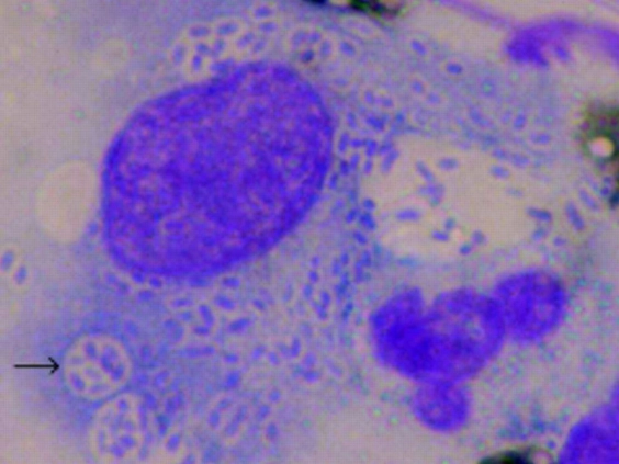 QChannel41's tweet photo. @WorldChannelCe1 a typical scan of how the disease starts and spreads
A necrotic infection is deep, smelly and causes damage to tissues

#teencorrode
#teenputrefaction
#TP1 https://t.co/aJmVeviVb5