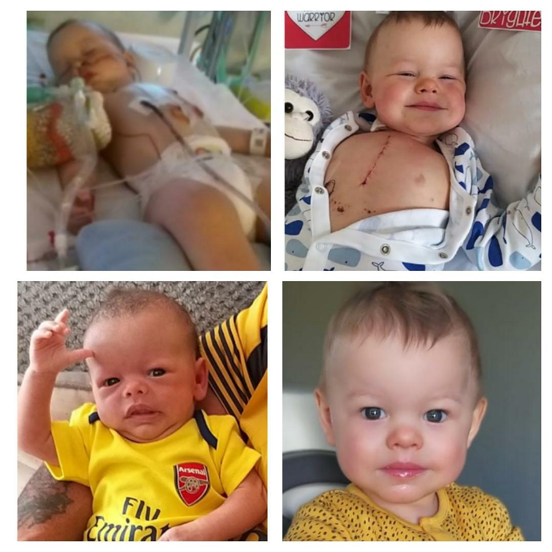Growingwiththe2's tweet photo. @piersmorgan I'm walking/ running 84 miles in 24 hrs to raise awareness for my son who has a rare condition called William's syndrome,  hes 17mths and 7 weeks ago had open heart surgery please follow up the story and raise awareness @Samantha_Hendy @marcowww9 @carlhendyasw https://t.co/rXUuY6CGtj