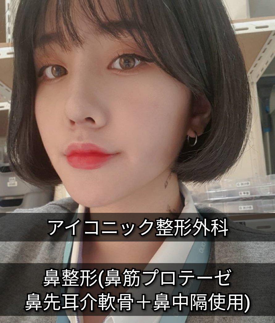 アイコニック 前tok 整形外科 皮膚科 Eyeconiqpsjapan Twitter アイコニック 前tok 整形外科 皮膚科 Eyeconiqpsjapan Twitter