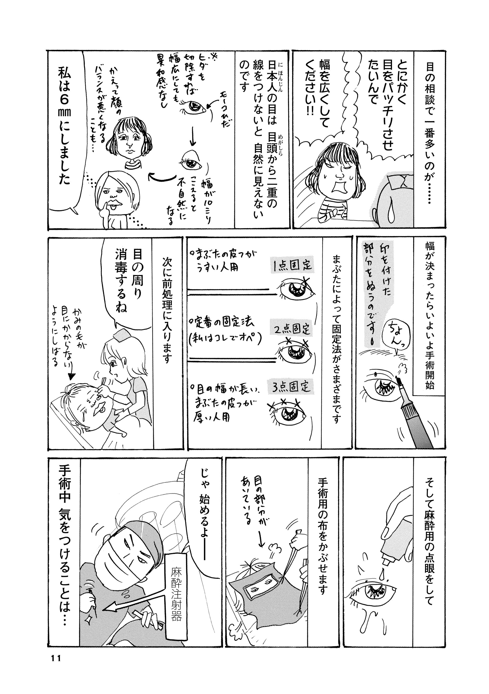 マンガよもんが 華のやらかし日記 公開中 役立つ整形手術事情も大胆告白 やらかし まくりの日常を極限までさらけ出した沖田 華の告白日記 続きはこちらから T Co A5gje2di2s マンガよもんが 漫画 マンガ エッセイ ４コマ 実録