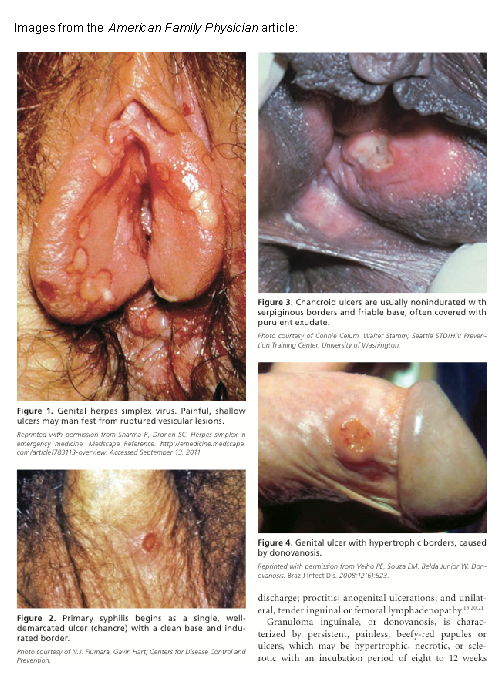 QChannel41's tweet photo. Pictures not for sensitive viewers

The ugly side of the disease
Protect yourself from all this by abstaining or using protection

@WorldChannelCe1 is here to educate and advice you on choices to make an informed decision

#teencorrode
#teenputrefaction
#TP1 https://t.co/3GQEMHEZhe