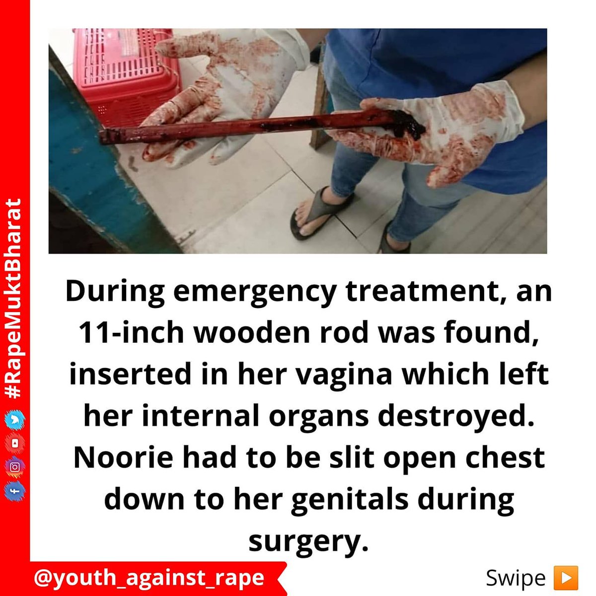 sai_rohith99's tweet photo. Noorie a friendly dog who is a part of nature a few perverts brutally raped her and also inserted a 1qinch rod in her private part 
Humanity goes on diminishing in society 
Even dogs has no security
I hope such to get a serious punishment by court of law https://t.co/gXpeMa6EYr