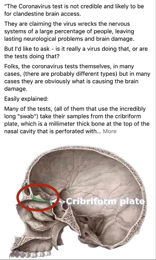 2020 recapped in images--NOT chronological