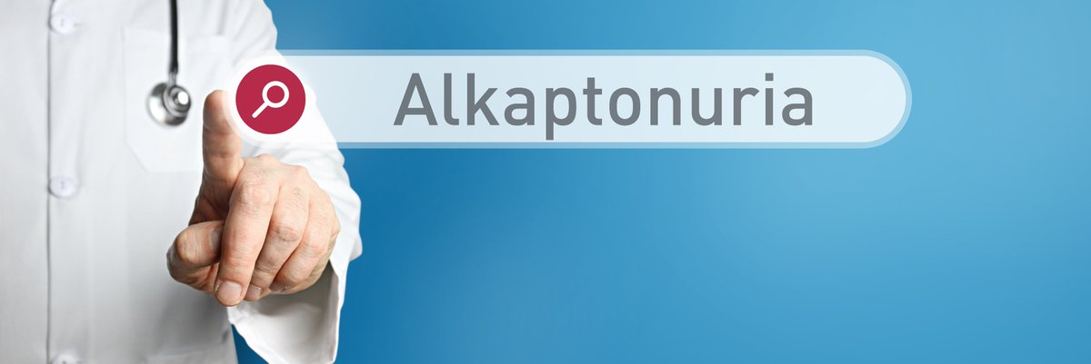 IreneNorstedt's tweet photo. A truly remarkable achievement for #Alkaptonuria sufferers as the @EU_Commission adopted today its Decision to extend marketing authorization to Orfadin👉https://t.co/gmtIraSrfs
Its development for the treatment of this #RareDisease was enabled by #EUfunded #DevelopAKUre. https://t.co/YJLtT6iSI2