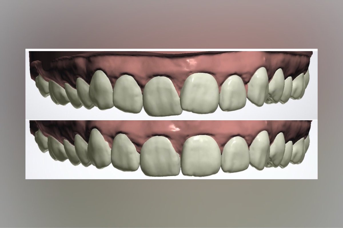 1dentallab's tweet photo. Creating Summer Smiles 💛🌞💛 https://t.co/afgSAVAjvR