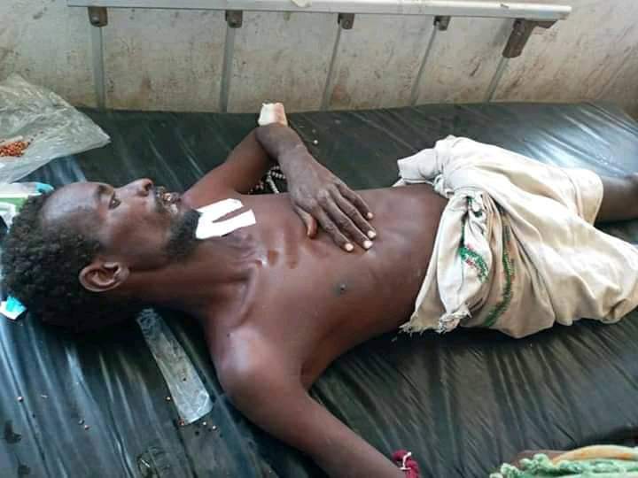 oladmohamed's tweet photo. Militias from #Afar region killed & injured scores in #GarbaIssa town, Sitti Zone of #Somali region. Since the illegal transfer of three Somali towns & their surrounding a few yrs ago, the constant tormenting of innocent civilians along the Somali-Afar border has become the norm. https://t.co/MFByZ1IJQP