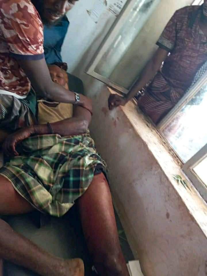 oladmohamed's tweet photo. Militias from #Afar region killed & injured scores in #GarbaIssa town, Sitti Zone of #Somali region. Since the illegal transfer of three Somali towns & their surrounding a few yrs ago, the constant tormenting of innocent civilians along the Somali-Afar border has become the norm. https://t.co/MFByZ1IJQP