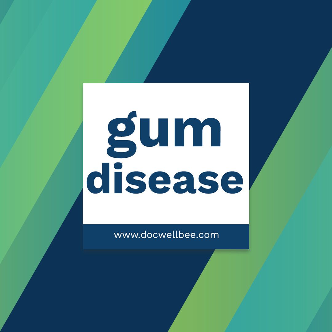 Docwellbee's tweet image. “Gum disease” also is called “periodontal disease.” Periodontal disease is an inflammation of the gums that, if severe, can lead to the loss of the tissues that hold your teeth in place. It is caused by plaque, a sticky film of bacteria that forms constantly on teeth.