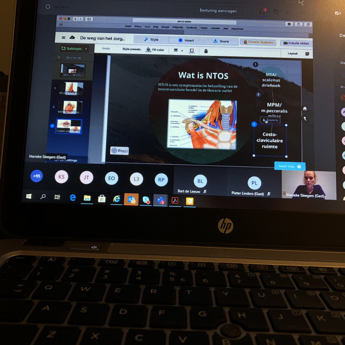 Scholingsavond (online) van <a href="/SNZON_Schouder/">SNZON</a> met Marieke Sleegers (nTOS) en Renske Janssen en <a href="/JosIJspeert/">Jos IJspeert</a> over de samenwerking #ergotherapie en #fysiotherapie bij de behandeling van Neuralgische Amyotrofie.