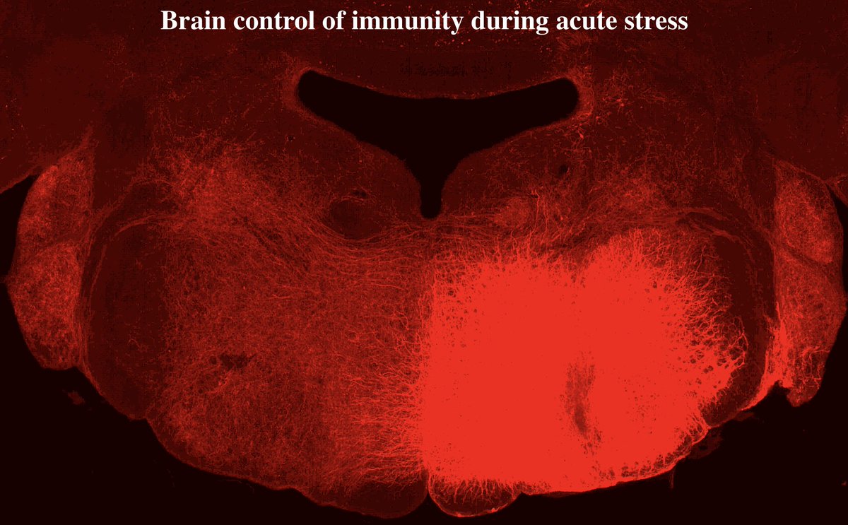 This week at Cardiometabolism virtual seminars <a href="/atherometab/">Cardiometabolism Virtual Seminar Series</a> 

Christian Wolfram Poller, M.D. (Massachusetts General Hospital): "Brain control of immunity during acute stress"

Friday, October 30th, 12 noon EST (Zoom: 692-600-595)
