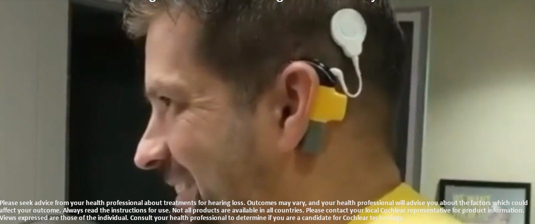 CochlearUS's tweet photo. Watch @YahooNews’ story on Gerid, a man who gained a new perspective on life after getting cochlear implants: https://t.co/lDaZhPBNIm https://t.co/B6J3jU5DFR