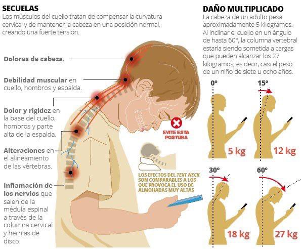 alfredomartiz's tweet photo. ✅Cápsula💊salud. Cada día más personas tienen dolor de cabeza, cuello o espalda y una de las razones; es la mala postura que adoptamos al usar los celulares u ordenadores✅ https://t.co/hZxPeQPITf