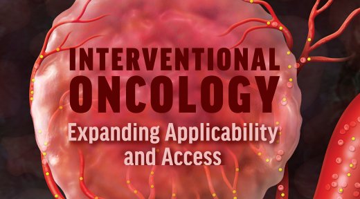 Read our latest Interventional Oncology issue that aims to provide practical insights for managing common oncologic problems, reviews the field of interventional neuro-oncology, &amp; perspectives on how health care disparities affect IR &amp; IO. 

View TOC: evtoday.com/issues/2020-oct