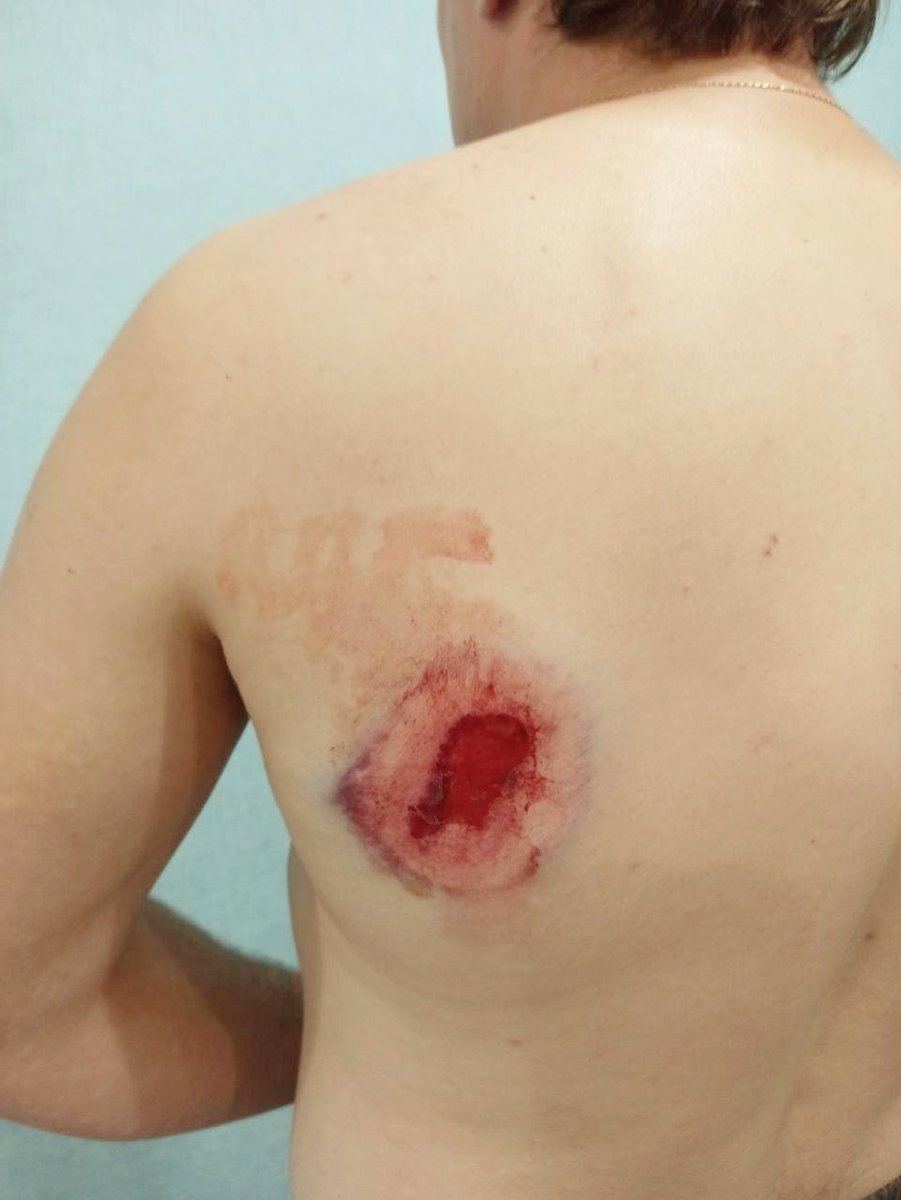 franakviacorka's tweet image. KGB claims the extremist actions of the protesters could be described as an act of terrorism. Meanwhile independent medics of Belarus published another evidence of police actions during the People's Ultimatum March which took place on Oct 25th.