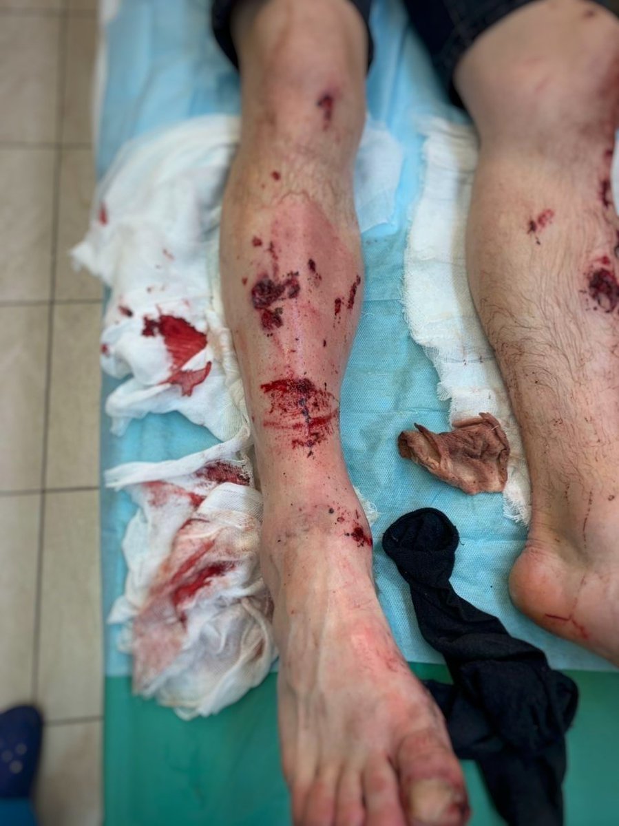 franakviacorka's tweet image. KGB claims the extremist actions of the protesters could be described as an act of terrorism. Meanwhile independent medics of Belarus published another evidence of police actions during the People's Ultimatum March which took place on Oct 25th.