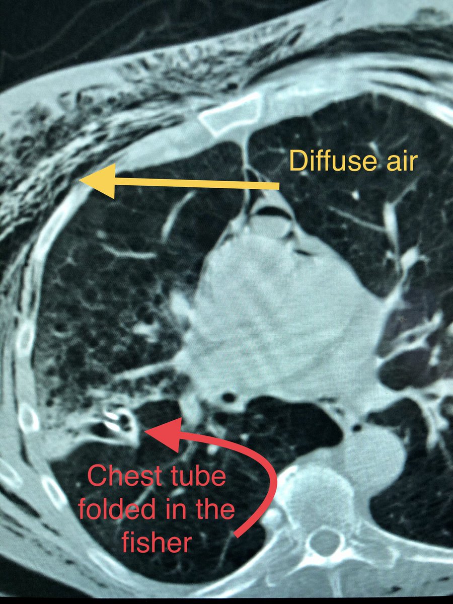 zachary masi tweet media