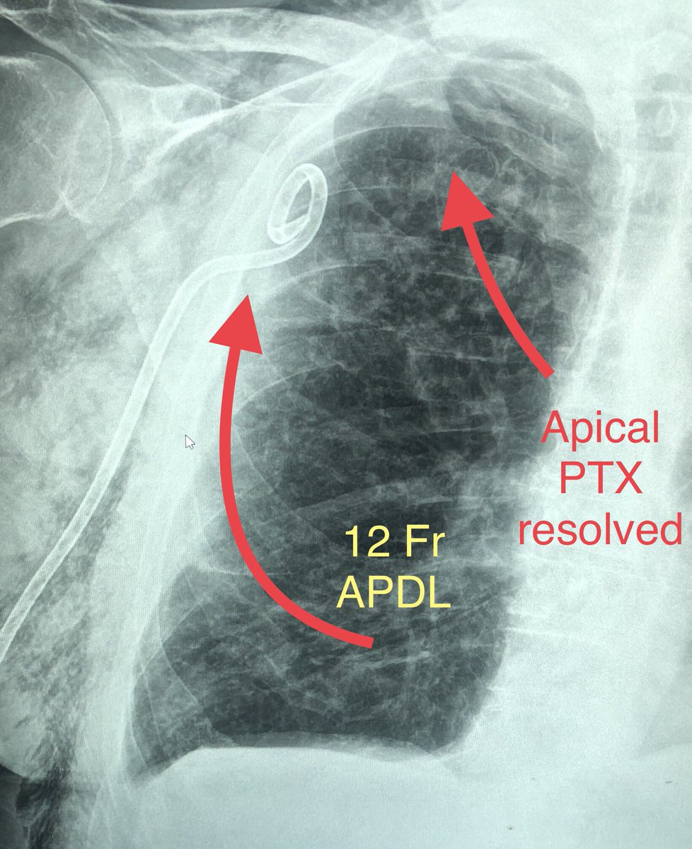 zachary masi tweet media