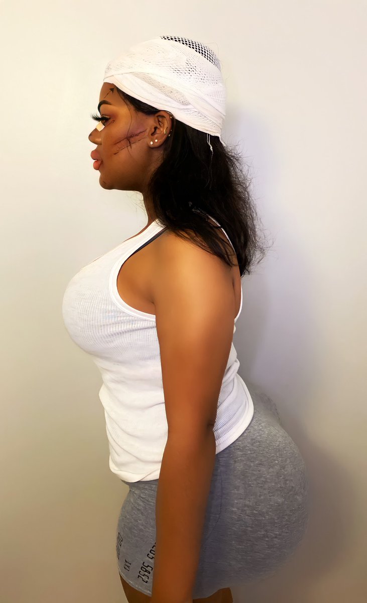 PRETTY HURTS🥀 #BOTCHED 
#Eshtober