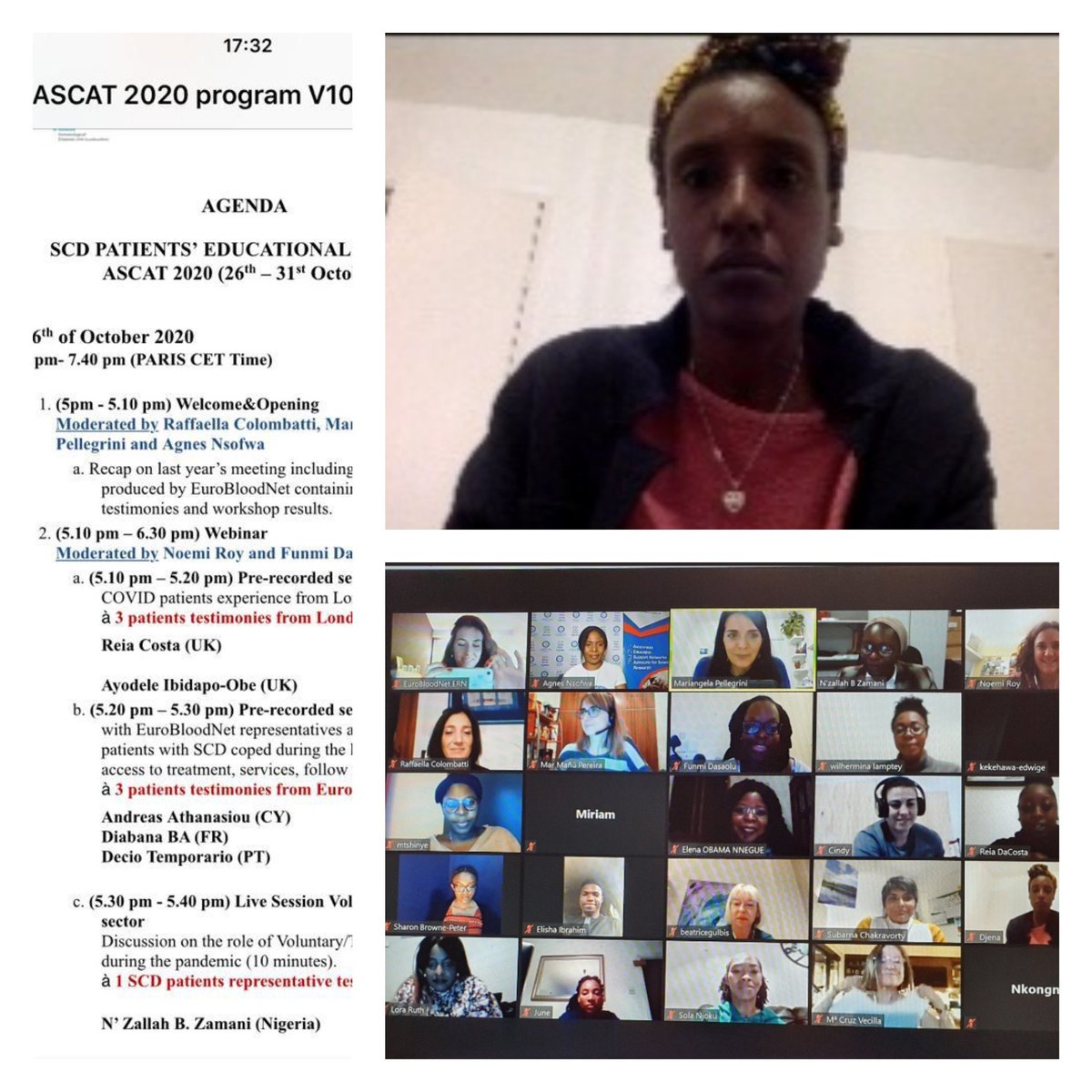 FMDTsosglobi's tweet photo. We were thrilled to be part of the SCD Patient's educational panel that took place during #Ascat2020 ! Thanks all for the great conversation around SCD management and to @ERNEuroBloodNet who convened this session!
#SickleCell #sosglobi #drépanocytose https://t.co/LDZ2caK8E0