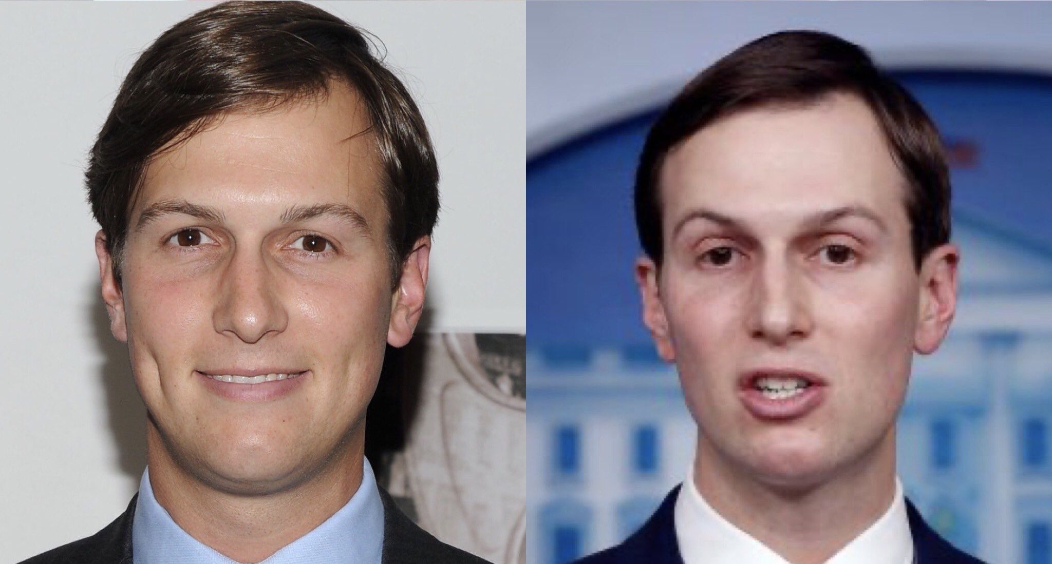 Jared kushner cheap plastic surgery