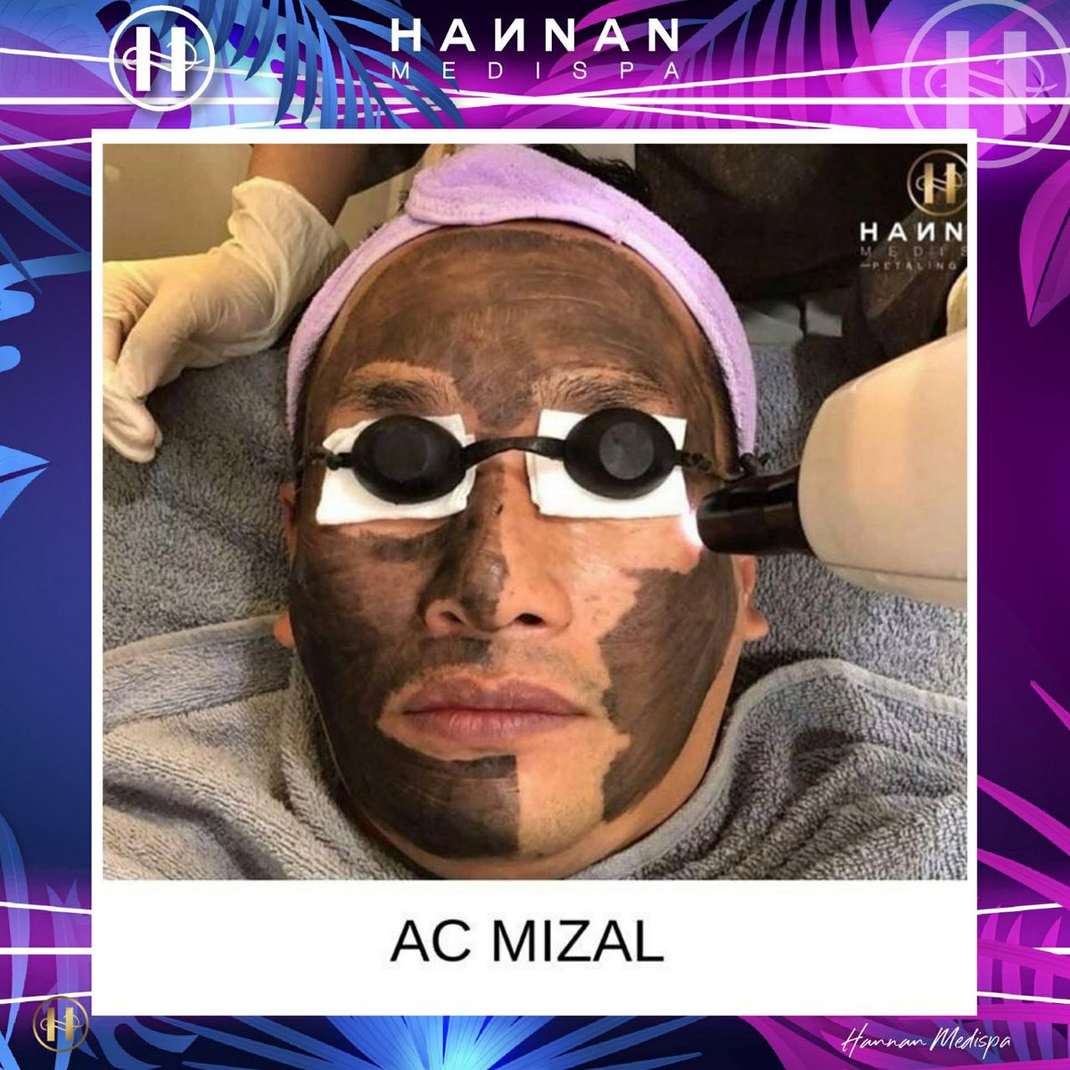 Uzivatel Hannan Medispa Parit Buntar Na Twitteru Terima Kasih Ac Mizal Kerana Mempercayai Service Kami Jangan Kata Wanita Lelaki Pun Boleh Tau Dapatkan Service Rawatan Muka Di Hannan Medispa Sekarang Ni