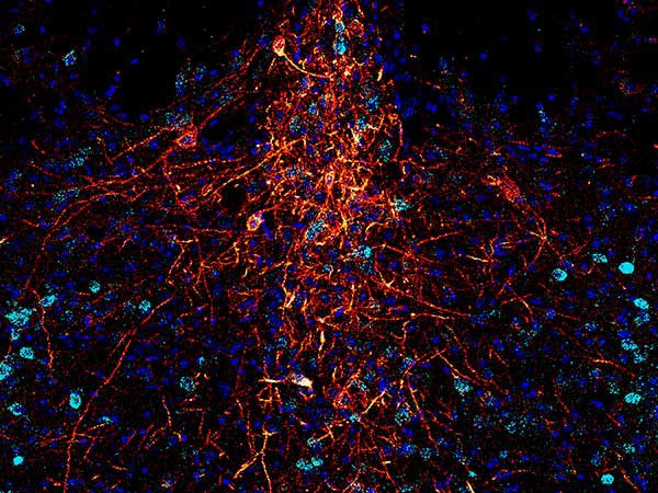 sanjivnimantra's tweet image. #NeuralCircuit
#Optogenetics

No implant needed for precise Control Deep into the brain.