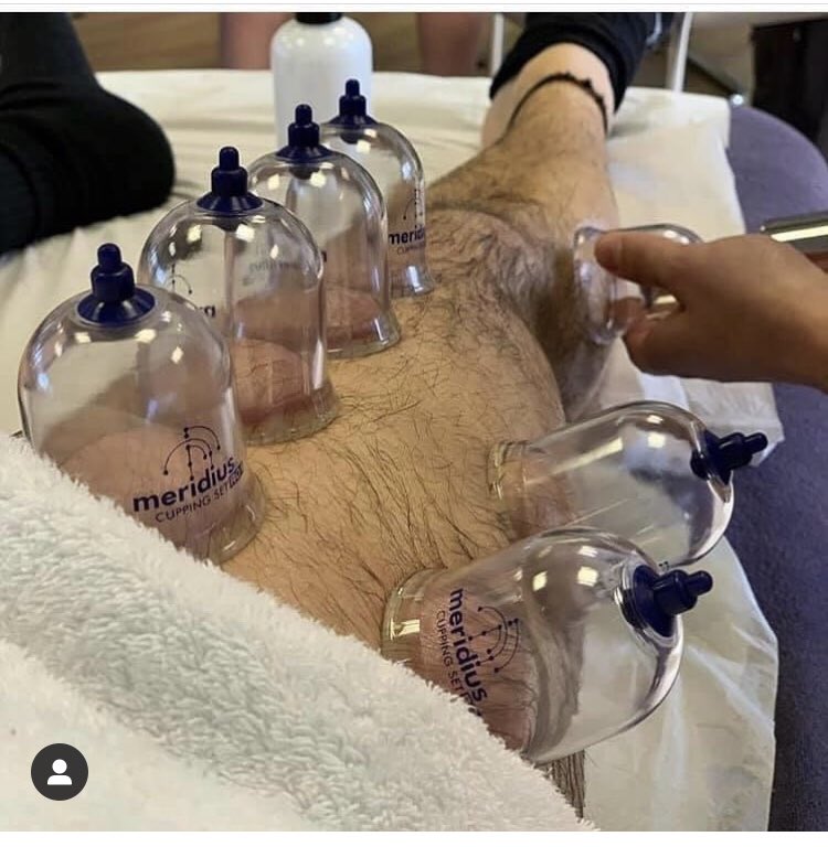 Core_Elements1's tweet photo. ✨ Our #Live #Online #CPD in #Dry #Cupping is now Fully Booked for December

But 1 is space available for our #Face2Face course in #December ..... 

Spaces are available for our #Live #Online course in #January 2021 👍 

✨ #accredited &amp; #insurable. 

👉 https://t.co/GtCvBquxuZ https://t.co/IJSk6x6Htc