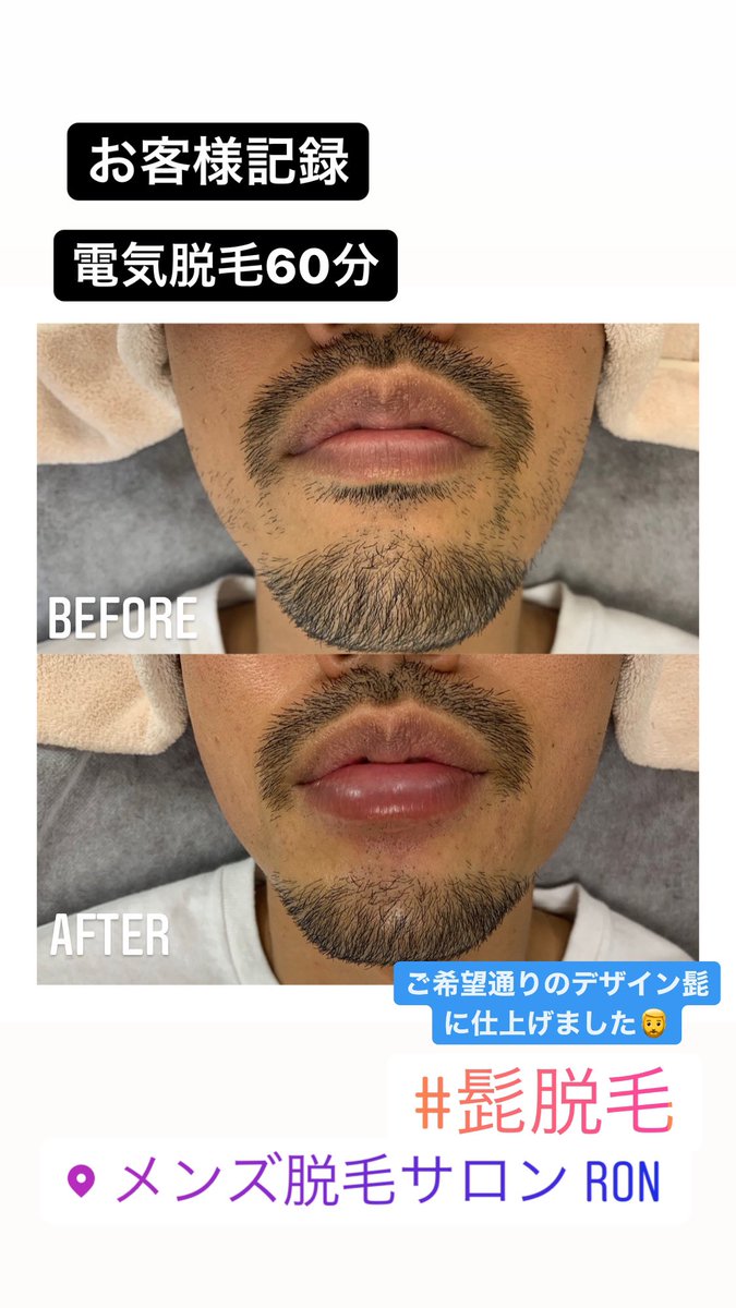 デザイン髭 デザイン髭