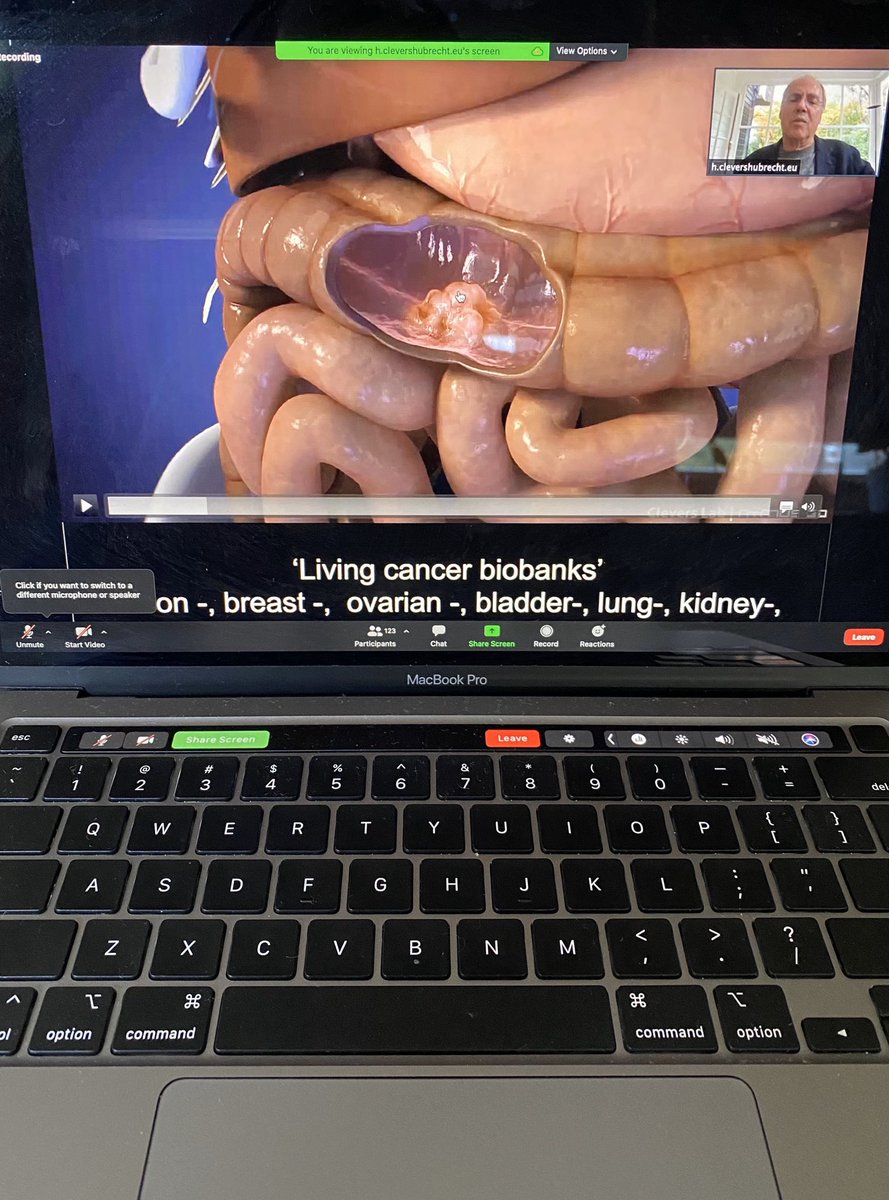 Isra_canadas's tweet photo. Amazing @FoxChaseCancer seminar from the one and only @HansClevers @TheCleversLab #cancerorganoids #cancerresearch https://t.co/hEHnmGxS9l