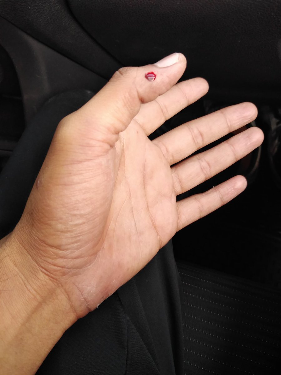 Salí rápido del cajero por verle el chile a un cabron y me caí a 4 patas #prostidrag 
Buen recibimiento Gdl
