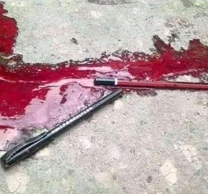 Shafiiq_R's tweet photo. This pic broke my heart 😭💔
Tears instead of Dreams in his eyes
#Peshawarblast
#پشاوردھماکہ_ذمہ_دارحکومت https://t.co/OcbrUkQHHH