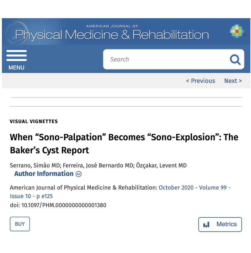 AAPhysiatry_RFC's tweet photo. When #Sonopalpation becomes a Sono-explosion! #POP on over to the October issue of #AJPMR to check out the article by Serrano et al and their memorable encounter with a Baker’s Cyst that gives #Popliteal a whole new meaning https://t.co/9YDdj7eej4
#Physiatry #ultrasound #meded https://t.co/zYbhgyKjh2