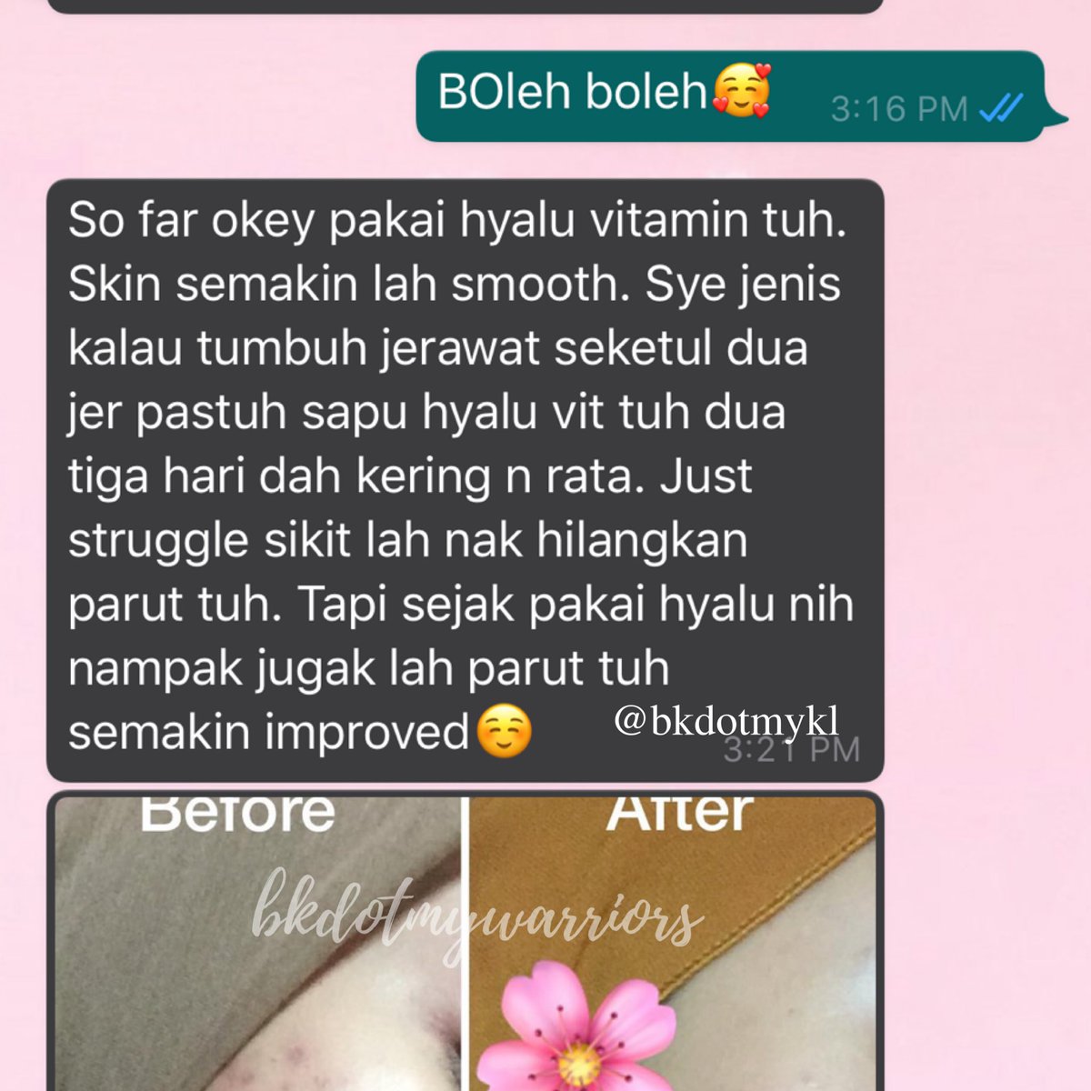 bkdotmykl's tweet photo. Takde guna benda pelik pelik pun , sebab I try menjadi orang try penjadi why not you guys try mana tahu serasi juga 🥰
Cc @bellakhann @bkdotmy 
#bkdotmy #bkdotmyfeedback  #bellakhann #skincareroutine #arbutin #centella https://t.co/dgyih0JAHG