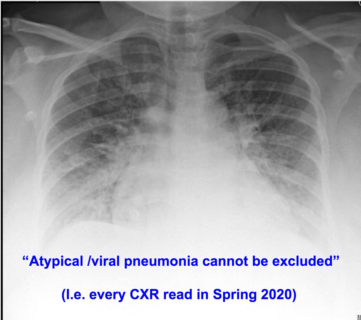 Well, she *also* has dyspnea on exertion, orthopnea, and peripheral edema. This is at the height of our COVID surge in the spring, mind you. PCR is (-), but the CXR … 3/20